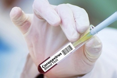 В Ростовской области 653 аппарата искусственной вентиляции легких (ИВЛ)